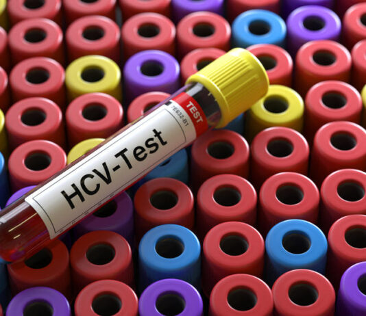 Badanie HCV – na czym polega, co wykrywa? Gdzie można zgłosić się na badanie HCV?